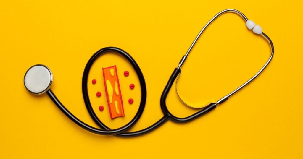 Atherosclerosis disease, narrowing of arteries due to plaque buildup on the artery walls. Treatment of blockage of flow in vessels and regulation of blood pressure. Cholesterol and blood clots.