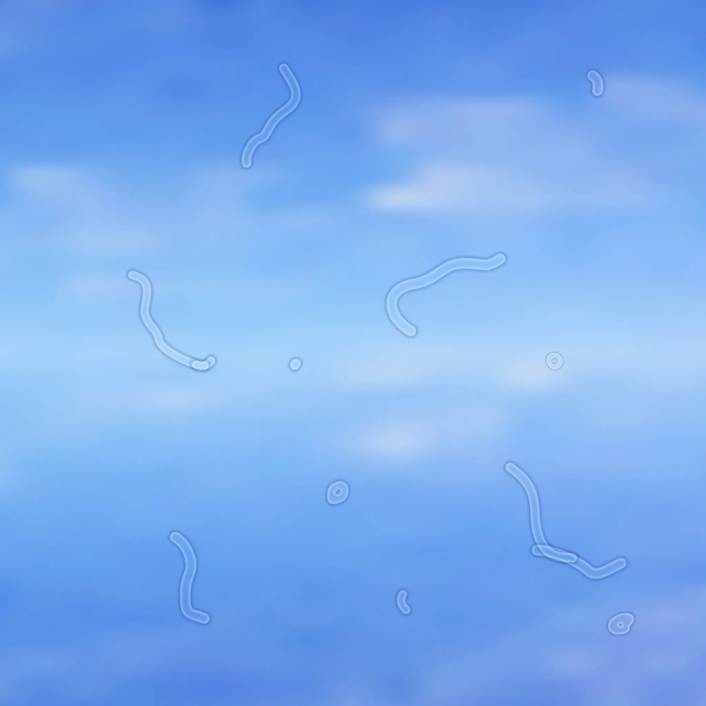 Eye ‘floaters’ are not usually a concern.