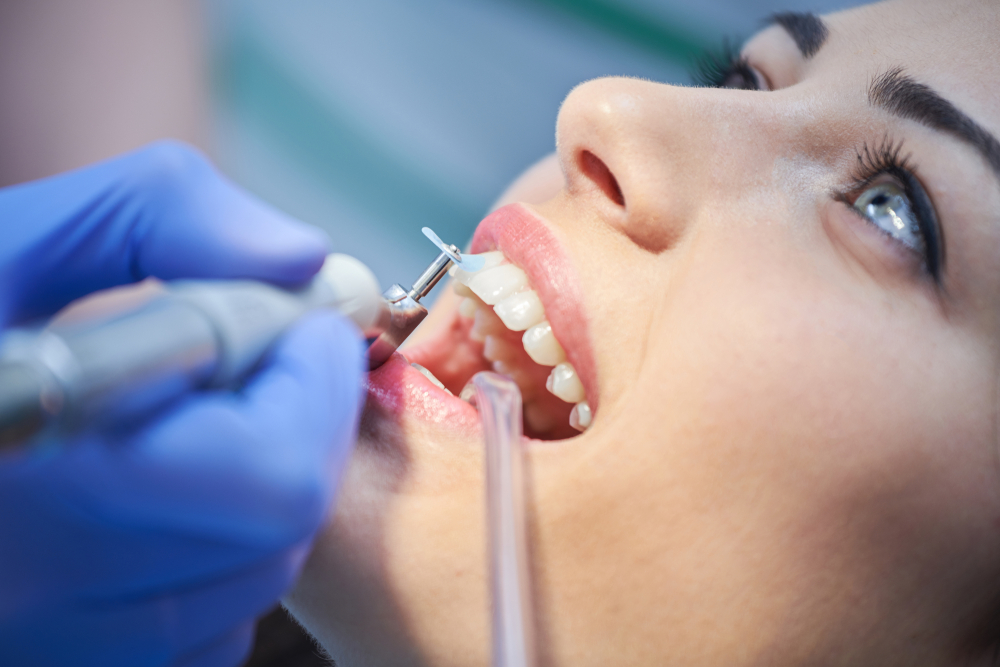 close-up medical dentist procedure of teeth polishing. Dentist making professional teeth cleaning female young female patient at the dental office. Close-up plan