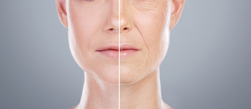 Collage, before after and face of woman for skincare, anti aging and beauty with surgery in studio. Female model, transformation and makeover with treatment, dermatology and change by gray background
